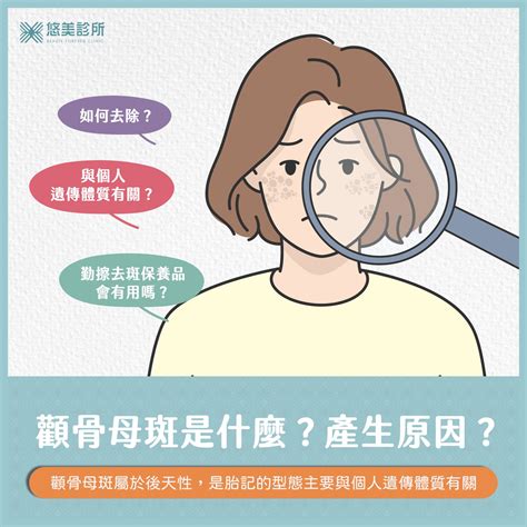 顴骨斑面相|如何從顴骨形狀看人的性格秘密？